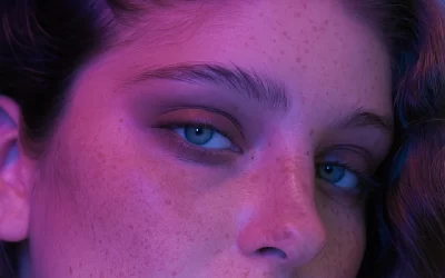 Como tratar manchas de sol na pele?